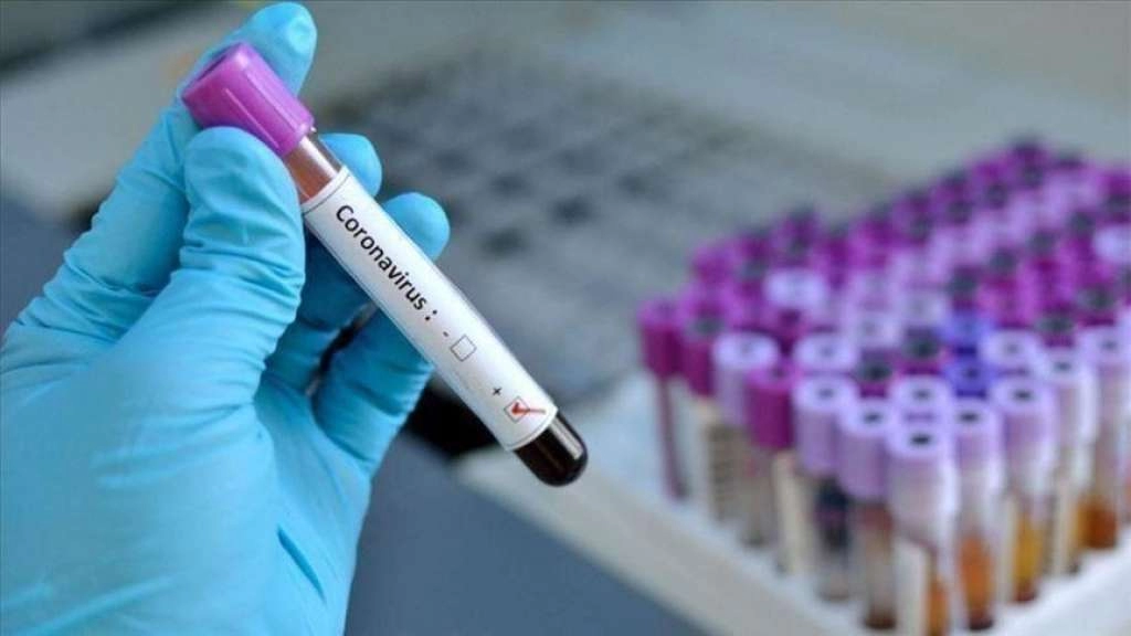 Šest osoba preminulo u FBiH od korona virusa u prvih pola godine